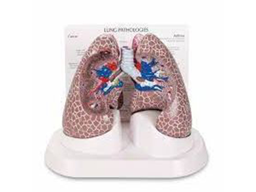 Lung Set with Pathologies
