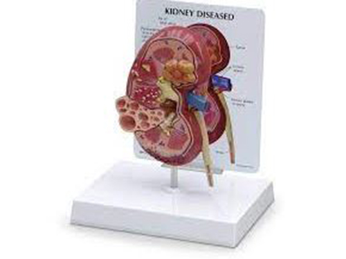 Kidney Model with Pathologies